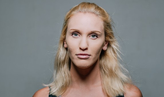 Alyse Dietel